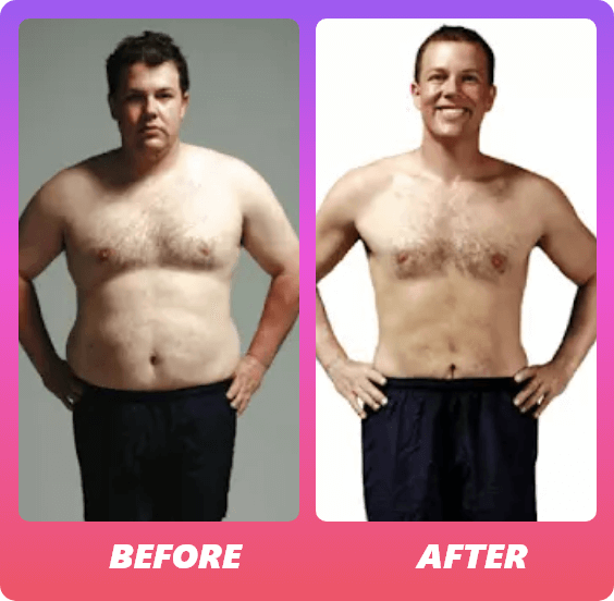 max30-before-after
