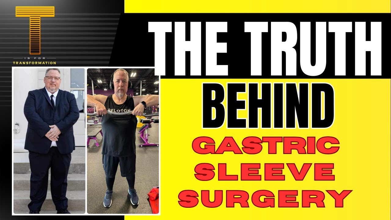 The Truth Behind Gastric Sleeve Surgery